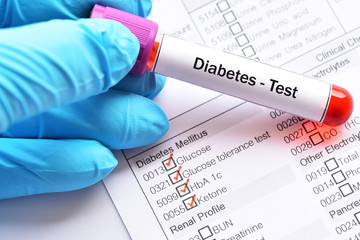 Blood sample for diabetes diagnosis 