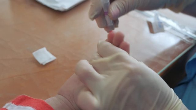 Nurse takes blood from a finger of child in medical laboratory. Blood sampling from the finger into the test tube for a general analysis. finger prick blood