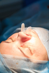 Fototapeta premium Plastic surgery of the nose in operating room, rhinoplasty