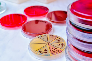 Petri dish. Microbiological laboratory. Mold and fungal cultures. Bacterial research
