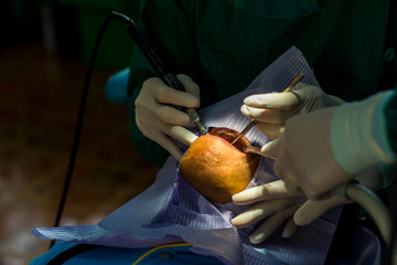 Dentist and dental assistant calculus removing. Dental Scaling.
