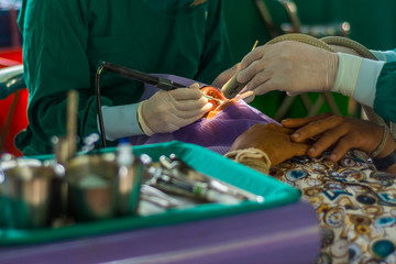 Dentist and dental assistant calculus removing. Dental Scaling.