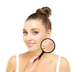 Post-Acne Marks /Treating Acne Scars.Acne Scar Removal