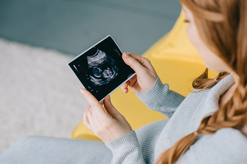 cropped image of attractive pregnant woman looking at ultrasound scan in living room