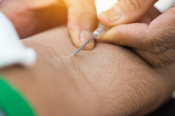 Obraz na płótnie Canvas Health and Medical concept. Closeup Hands nurse are using needle to pierce vein Preparation for blood test on table. Blood donation occurs when person voluntarily has blood drawn used for transfusions