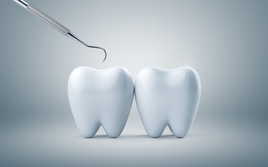 Teeth with dental plaque tool, Concept Dental care cleaning bacterial plaque on white background. 3d render