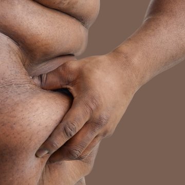 Overweight man pinching body fat on his waist