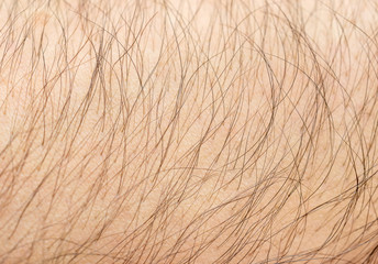 Texture of human skin with hair. Close up.