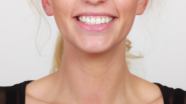 Happy smiling woman showing white teeth