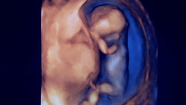 Image of a tiny human fetus in mother's womb