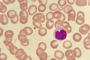 Lymphocyte cells (white blood cell) in blood smear, analyze by microscope