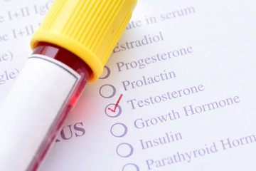 Blood sample for testosterone hormone test
 - obrazy, fototapety, plakaty