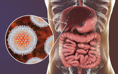 Hepatitis C virus infection medical concept, 3D illustration