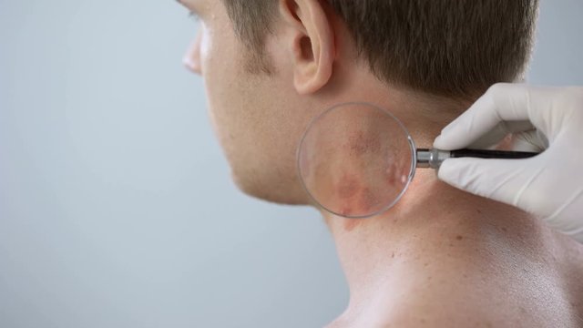Physician examines rash on patient neck, allergy treatment, contact dermatitis