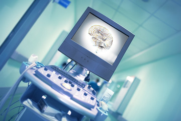 Human brain image on the display of medical equipment in the hospital corridor with blurred in motion silhouette of walking doctor