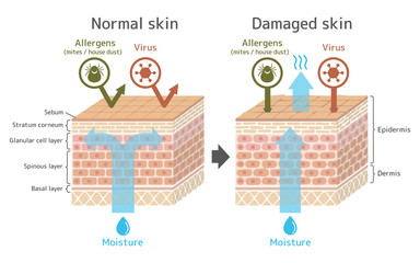 Sectional view of the skin.Comparison illustration of protection effect between healthy skin and wounded skin. With text.  - obrazy, fototapety, plakaty