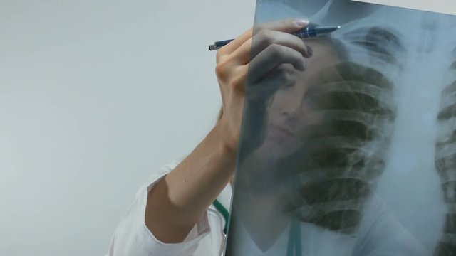 woman doctor examining the X-ray of the lungs