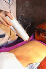 moxibustion