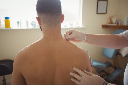 Physiotherapist performing dry needling on patient