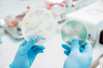 Looking on the effect of antibiotics on bacteria in Petri dishes at the laboratory. Making...