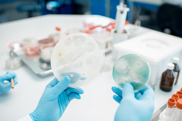 Looking on the effect of antibiotics on bacteria in Petri dishes at the laboratory