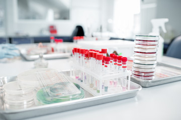 Test tubes with Petri dishes on the table in bacteriological department of laboratory