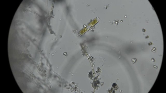 diatom algae in fresh water, under a microscope