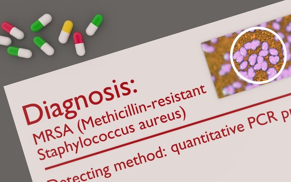 MRSA or Methicillin-resistant Staphylococcus aureus 3d concept illustration 
