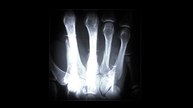 X-ray Body Parts. Alpha Channel Included.