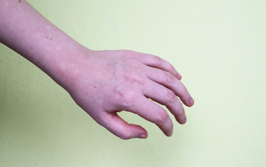 arm with visible veins