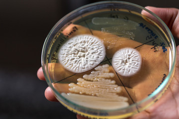 Fototapeta na wymiar Research of Bacterial and fungi in Petri dishes in laboratories for education in lab.