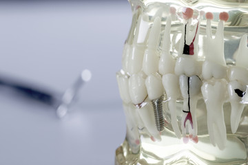 dental equipment 