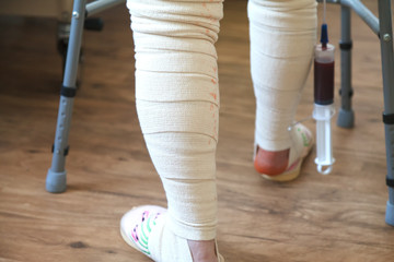 An elderly woman after an operation of endoprosthetics.