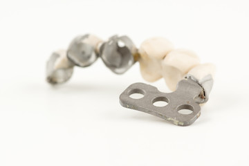 damaged dental prosthesis