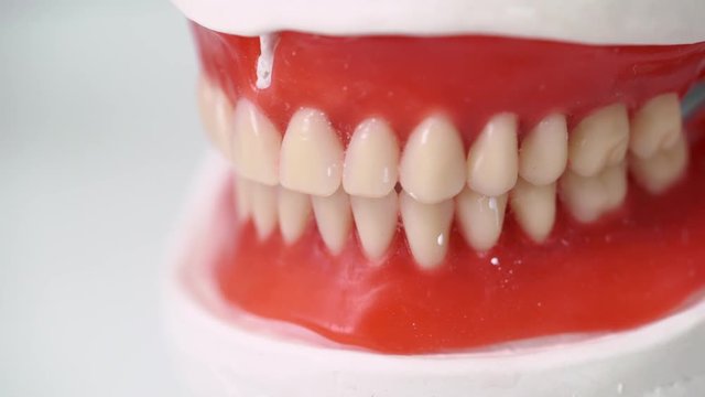 Jaw tooth model in dental clinic
