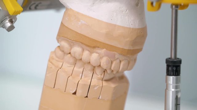 Jaw tooth model in dental clinic