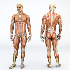 Vista frontale e di spalle di una persona ed i suoi muscoli con i trigger points evidenziati. Anatomia e corpo umano. Zone di muscolatura o fascia dense e dolorose alla palpazione - obrazy, fototapety, plakaty