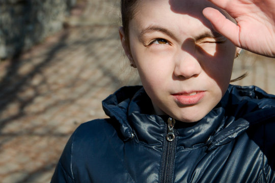 Portrait Of A Girl Looking At The Sun And Squinting Eyes From The Bright Sun