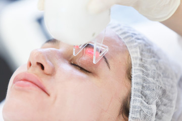 close up professional beautician making facial peeling in eyelids. Laser face peeling.