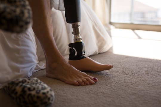 Low section of amputee woman with her artificial leg at home