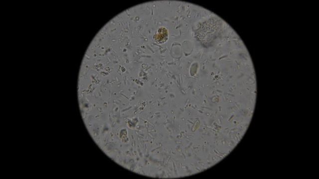 tests of liquid feces in a person under a microscope
