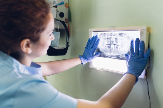 Female dentist looking at dental x-ray on lightbox