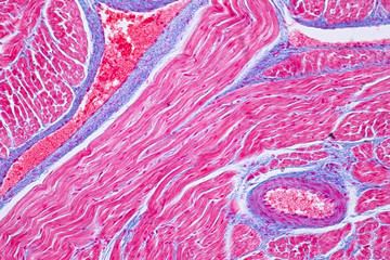 Histology of human cardiac muscle under microscope view for education.
