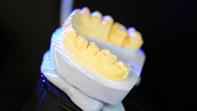 3D Scanning a model of human teeth from gypsum close-up. Creation 3D model for sculpted plastic denture in medical laboratory. Modern high tech digital scanning dental equipment prosthetic restoration