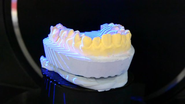 3D Scanning a model of human teeth from gypsum close-up. Creation 3D model for sculpted plastic denture in medical laboratory. Modern high tech digital scanning dental equipment prosthetic restoration
