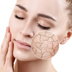 Zoom circle shows dry facial skin before moistening. - 201336068