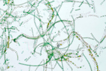 Filamentous algae are single algae cells that form long visible chains