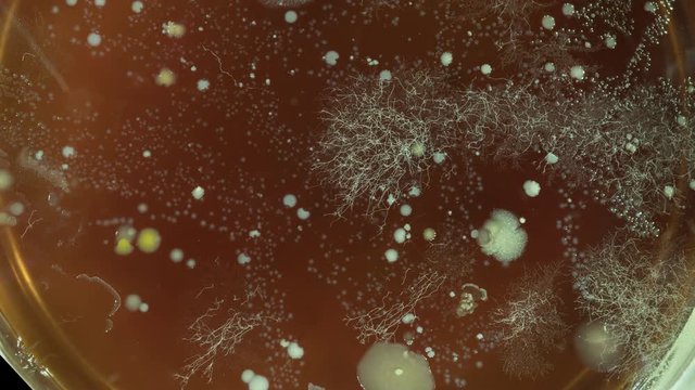 growth of bacteria taken in a bathroom in a Petri dish time lapse