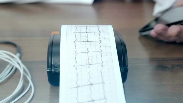 Doctor prints on the ECG ECG printer close-up