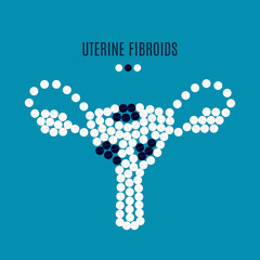 Uterine fibroids awareness poster with uterus made of pills on blue background. Medical solidarity concept for gynaecological clinics and maternity centers. Human body organ icon. Vector illustration.